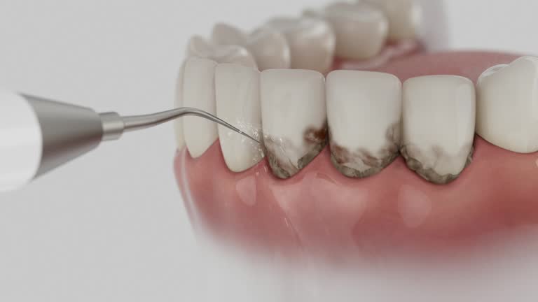 Trusted Tooth Extraction service in Batesville, AR - Dentist Open Now